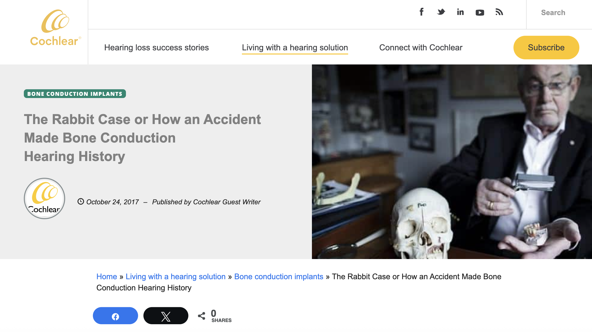 Professor Brånemark holding a dental mould to demonstrate how bone conduction hearing works.